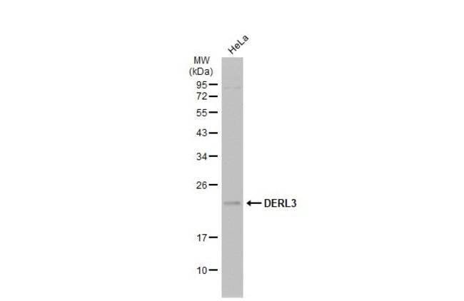 100uL Polyclonal antibody, DERL3, host r