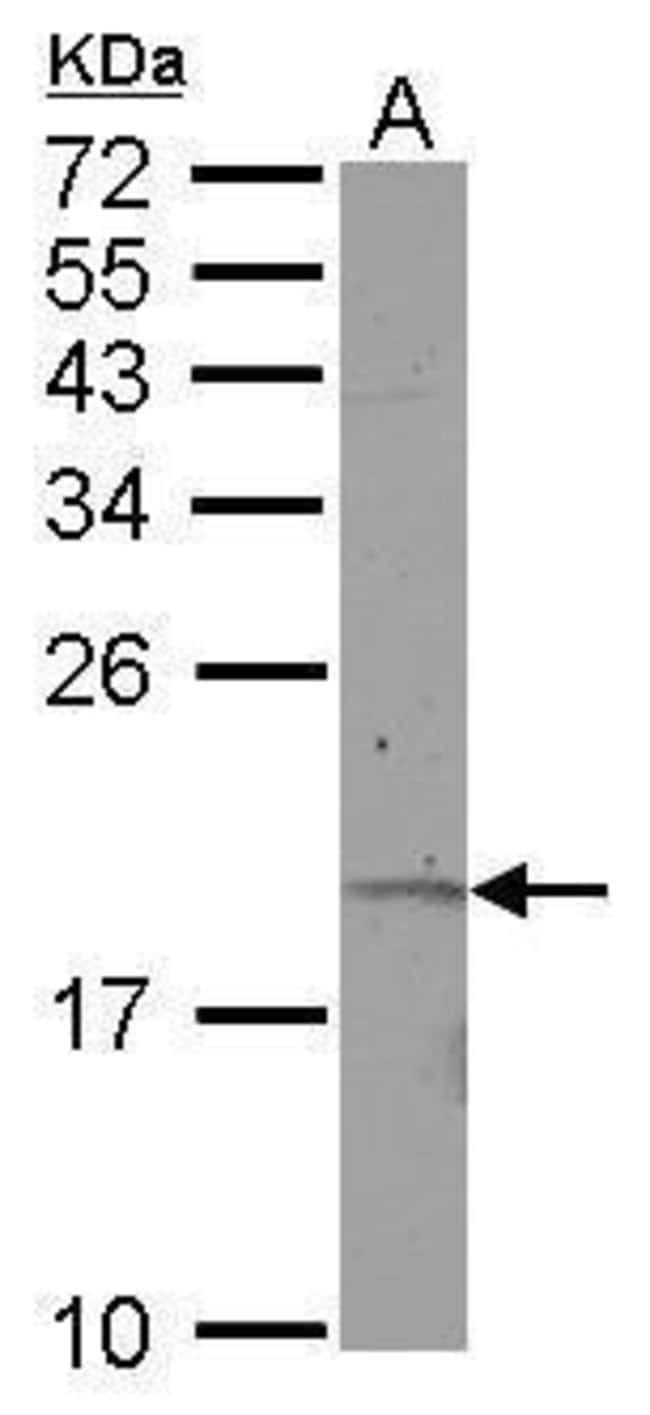 100uL Polyclonal antibody, KRTAP11-1, ho