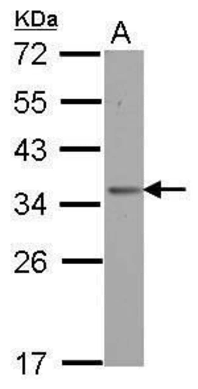 100uL Polyclonal antibody, OTUD6B, host