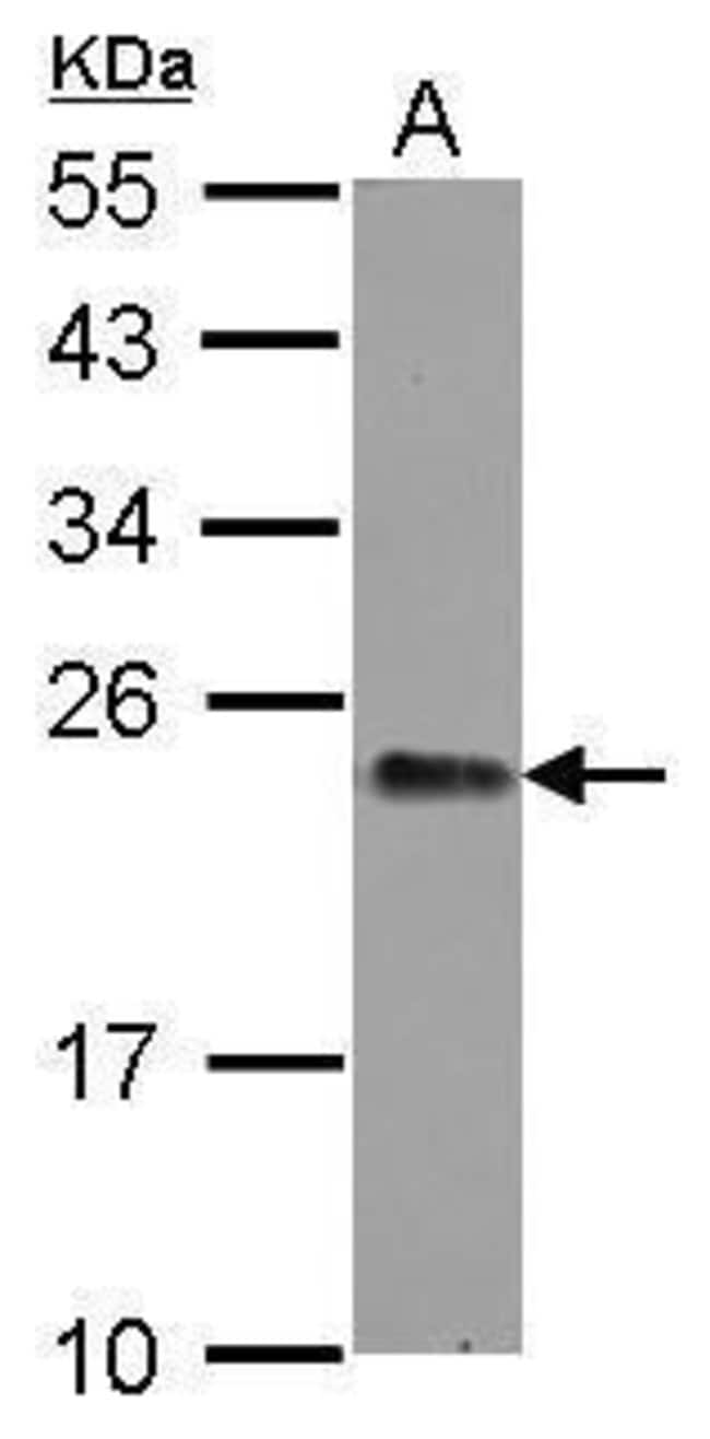 100uL Polyclonal antibody, GNPNAT1, host
