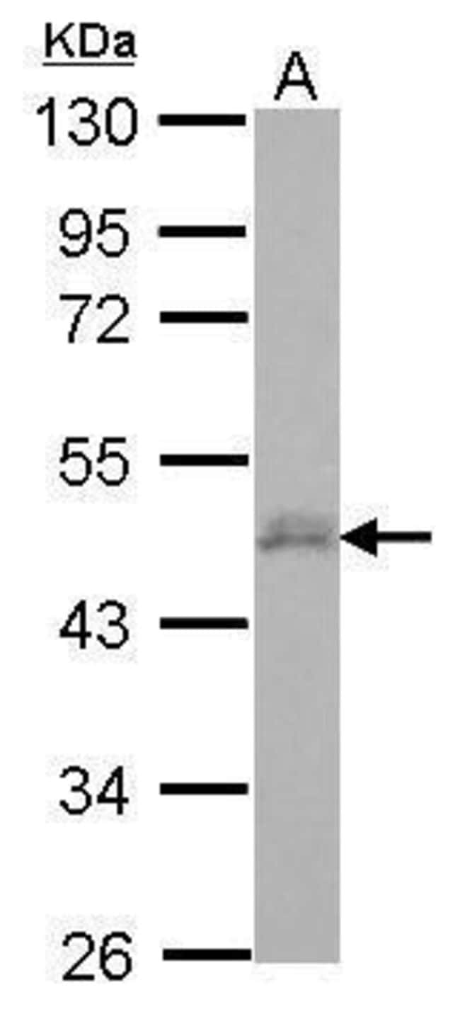 100uL Polyclonal antibody, CERD4, host r