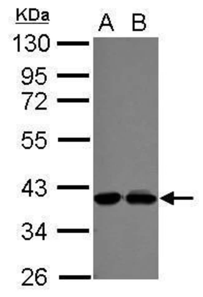 100uL Polyclonal antibody, POLdiP3, host