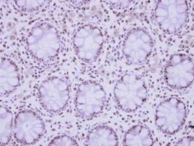 100uL Polyclonal antibody, ZNF418, host