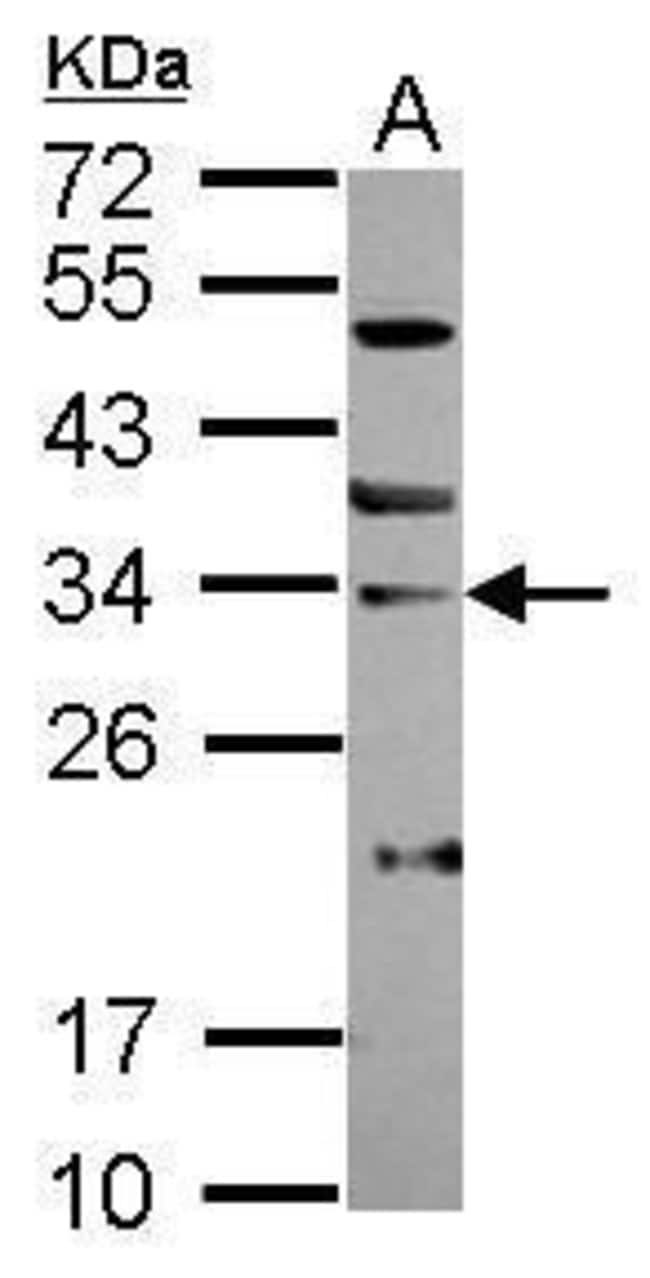 100uL Polyclonal antibody, SNAI3, host r