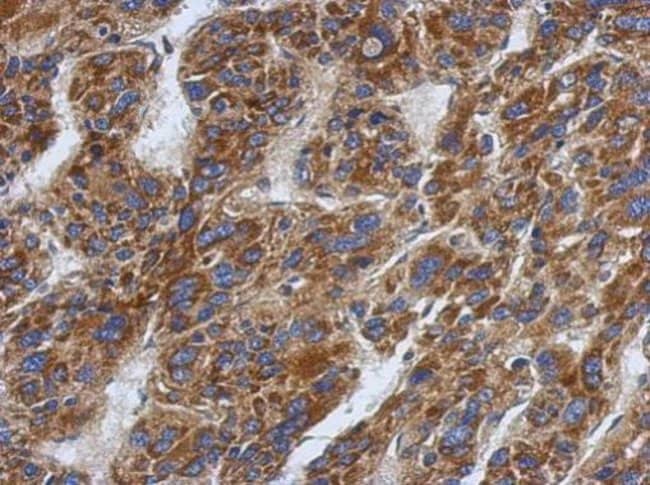 100uL Polyclonal antibody, SFXN1, host r