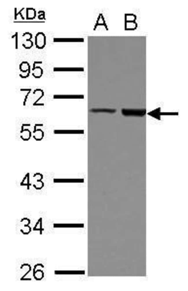 100uL Polyclonal antibody, FRMD8, host r