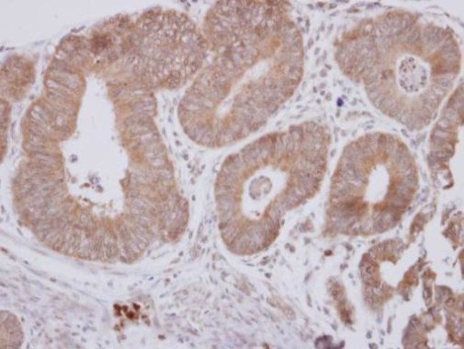 100uL Polyclonal antibody, CPEB, host ra