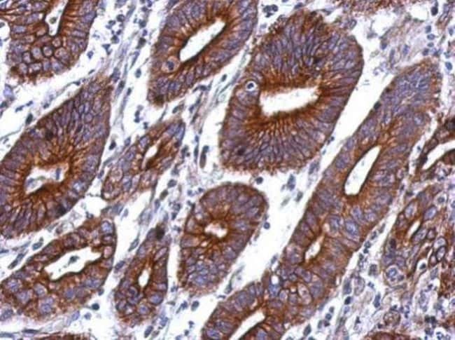 100uL Polyclonal antibody, CTAGE1, host