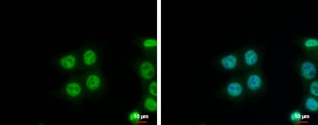 100uL Polyclonal antibody, NIP30, host r