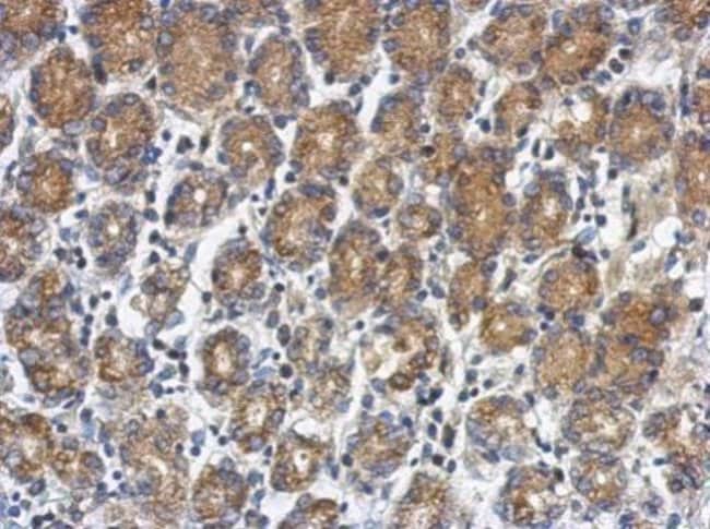 100uL Polyclonal antibody, RUNDC1, host