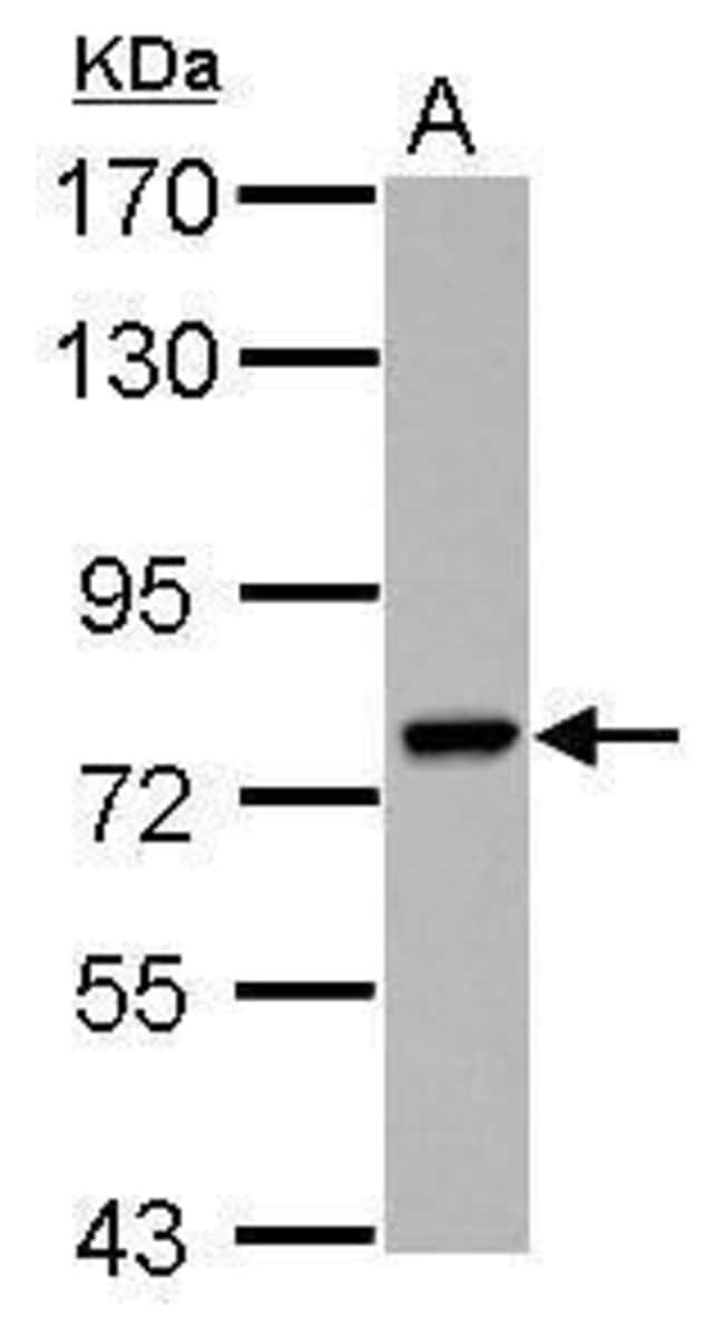 100uL Polyclonal antibody, PARP6, host r