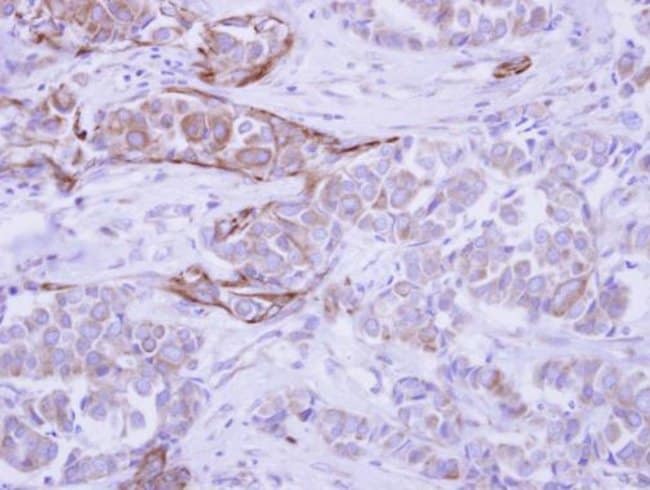 100uL Polyclonal antibody, WDR49, host r