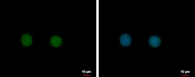 100uL Polyclonal antibody, C17orf49, hos