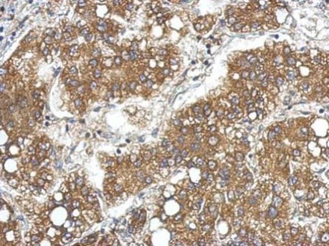 100uL Polyclonal antibody, lipocalin 15,
