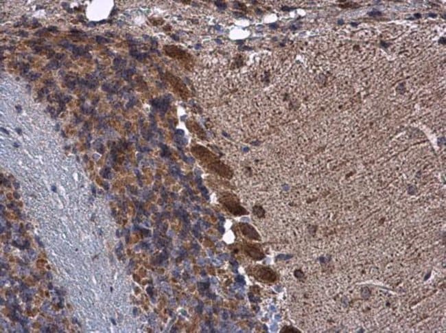 100uL Polyclonal antibody, KBTBD3, host