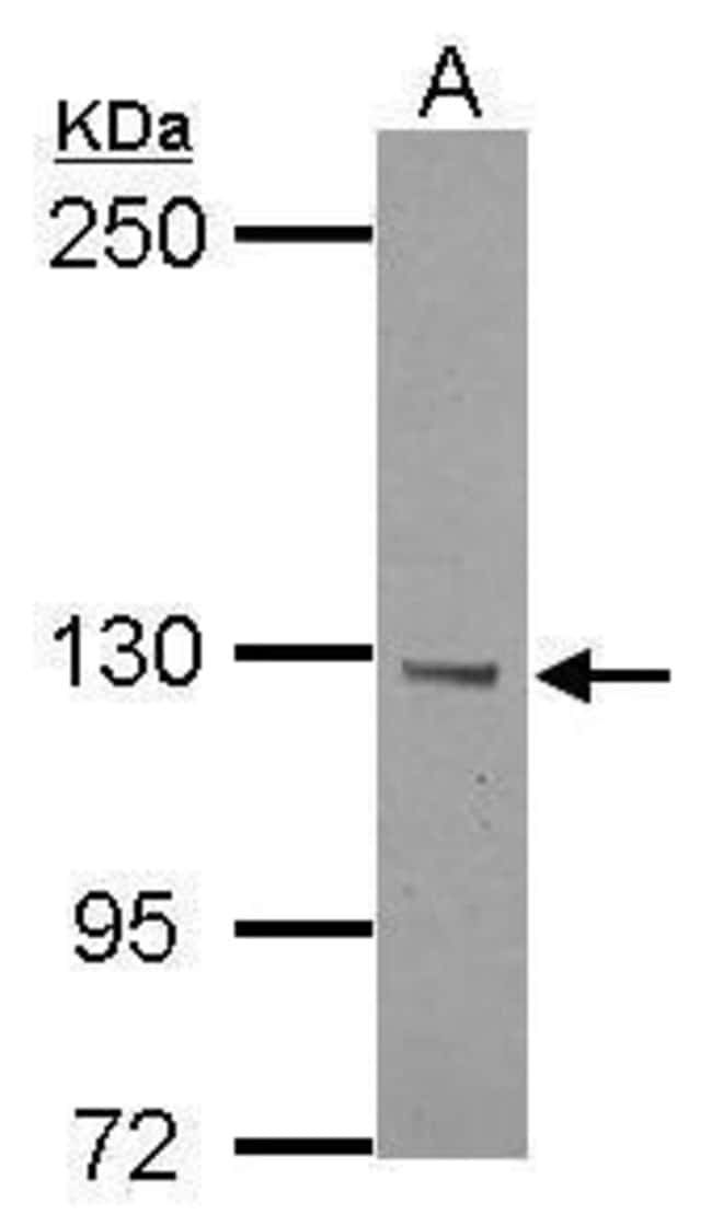 100uL Polyclonal antibody, BTBD7, host r