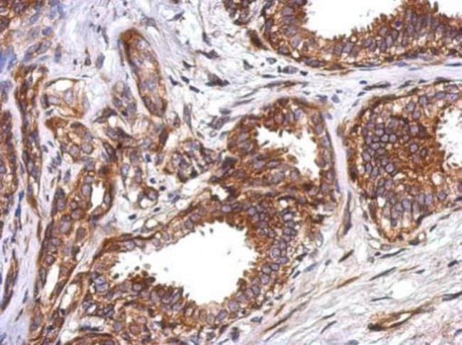 100uL Polyclonal antibody, tektin 5, hos