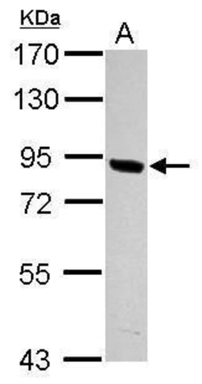100uL Polyclonal antibody, PNPLA8, host