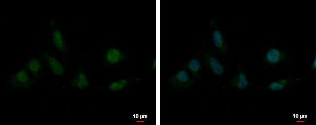 100uL Polyclonal antibody, SAP130, host