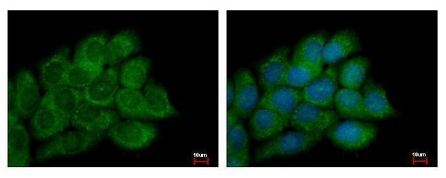 100uL Polyclonal antibody, PECI, host ra