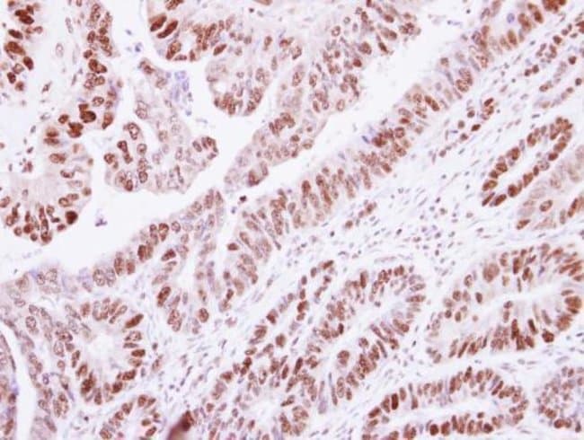 100uL Polyclonal antibody, histone H1.2,