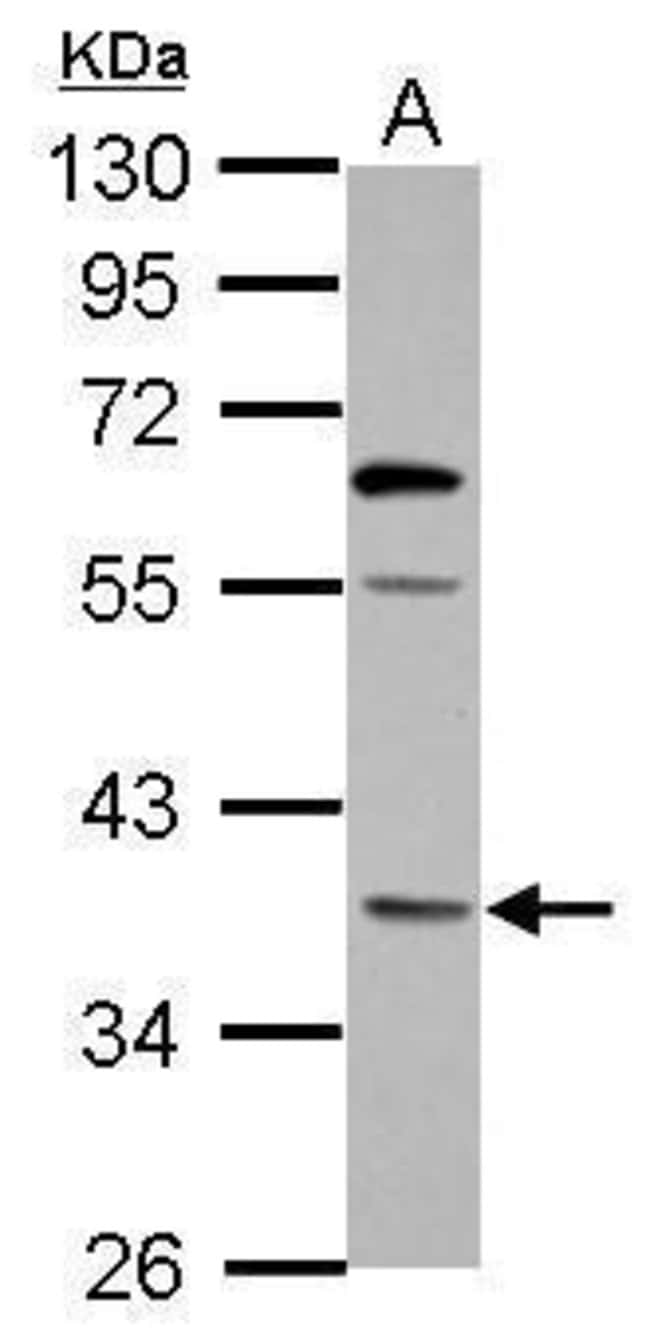 100uL Polyclonal antibody, OXNAD1, host