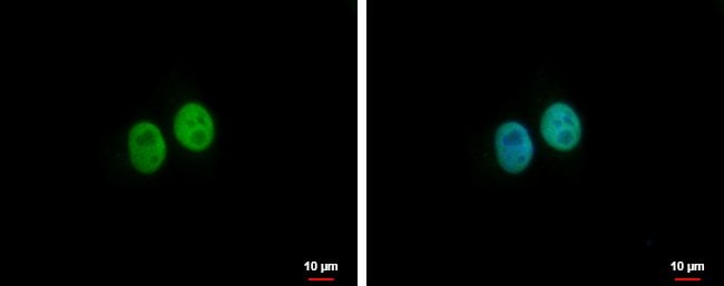 100uL Polyclonal antibody, BRMS1L, host