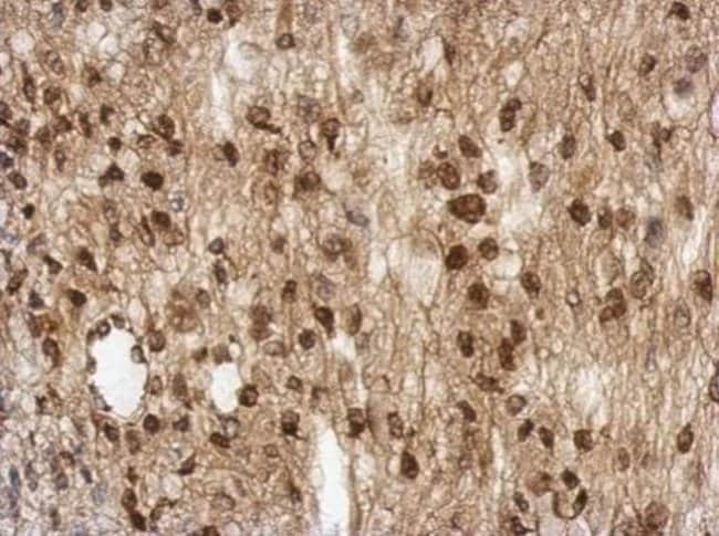 100uL Polyclonal antibody, TBC1D22A, hos