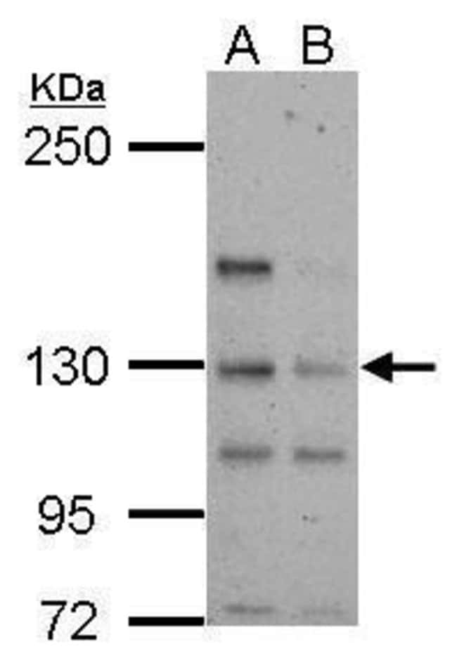 100uL Polyclonal antibody, TTLL4, host r