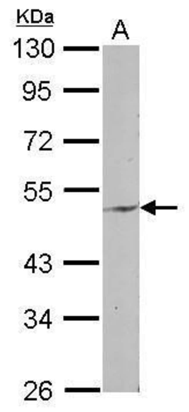 100uL Polyclonal antibody, ENPP6, host r