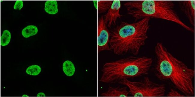 100uL Polyclonal antibody, histone H3 (a