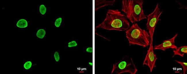 100uL Polyclonal antibody, histone H4 (a