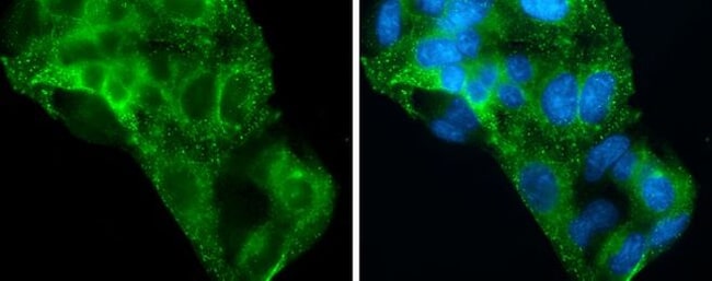 100uL Polyclonal antibody, ASGPR1, host