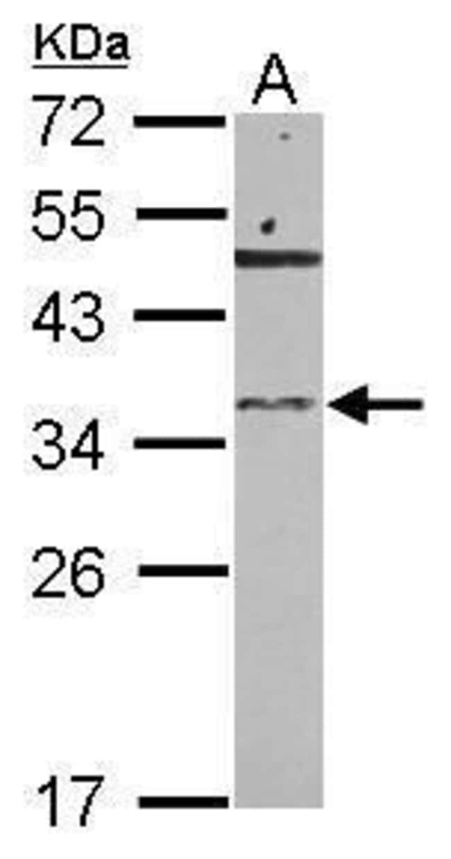 100uL Polyclonal antibody, ribonuclease