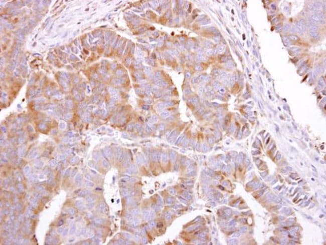 100uL Polyclonal antibody, PEPP2, host r