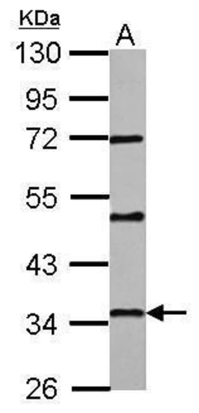 100uL Polyclonal antibody, PAQR6, host r