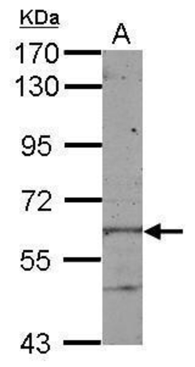 100uL Polyclonal antibody, KLHL28, host