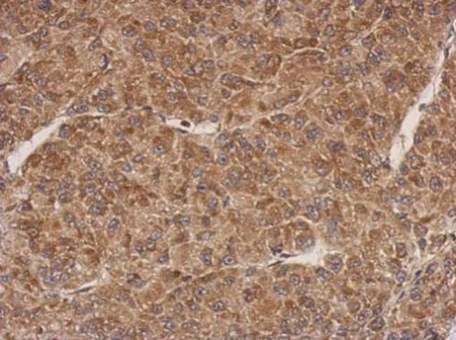 100uL Polyclonal antibody, PROSC, host r