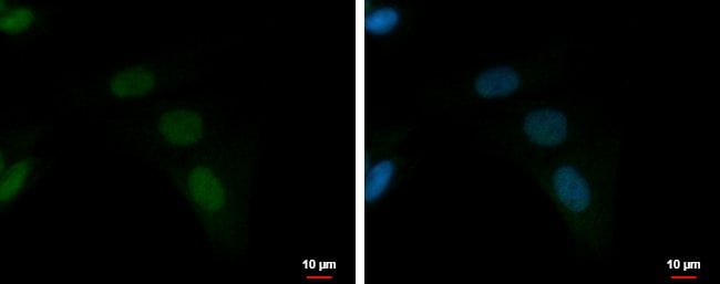 100uL Polyclonal antibody, ZFAT, host ra
