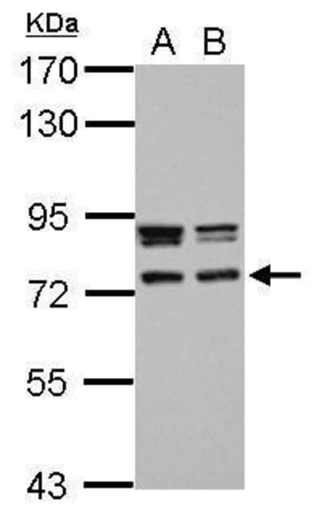100uL Polyclonal antibody, CCDC151, host