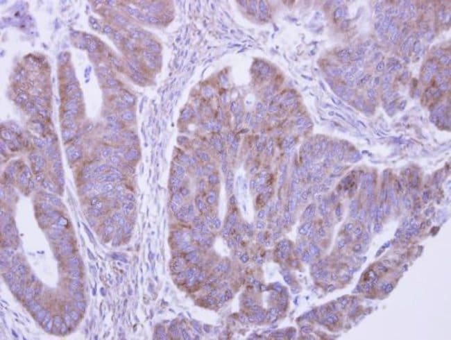 100uL Polyclonal antibody, LACTB2, host