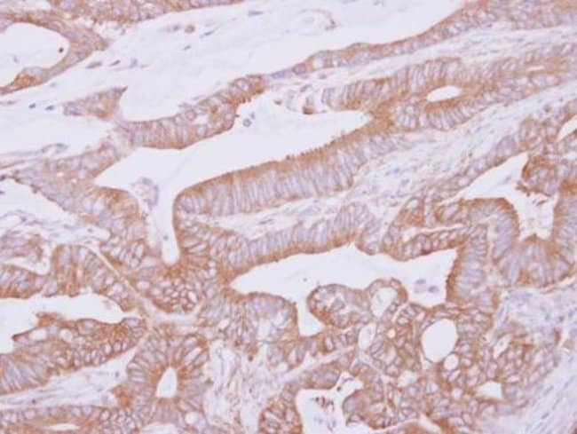 100uL Polyclonal antibody, THUMPD2, host