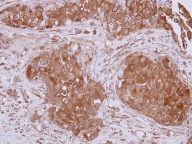 100uL Polyclonal antibody, STUB1, host r