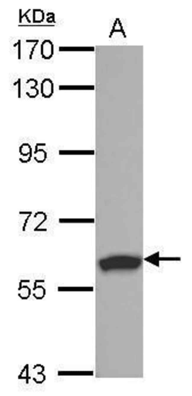 100uL Polyclonal antibody, RSPRY1, host