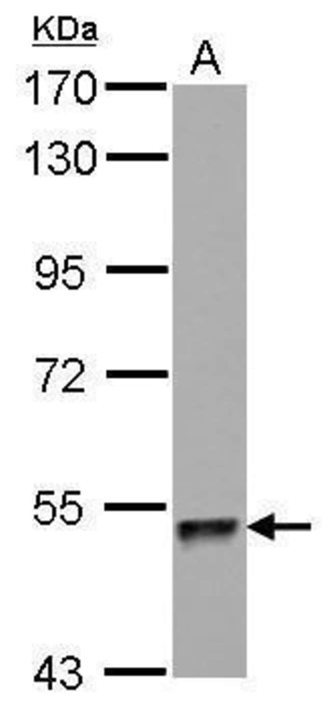 100uL Polyclonal antibody, ZNF689, host