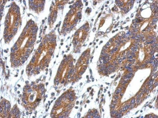 100uL Polyclonal antibody, CCDC127, host