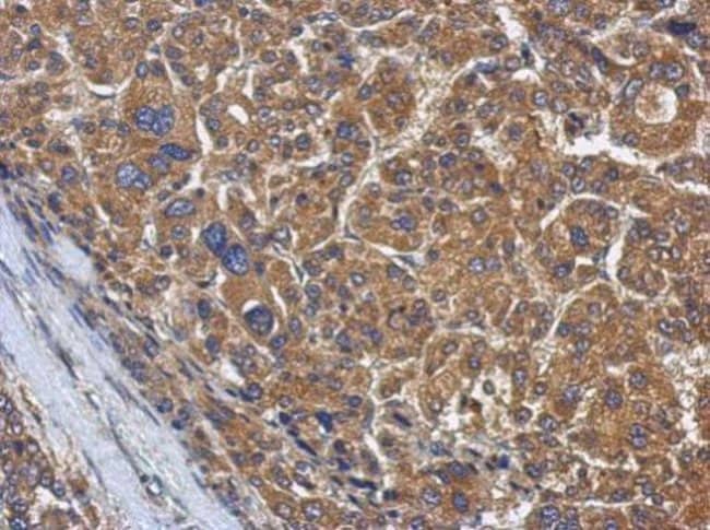 100uL Polyclonal antibody, KLHL22, host