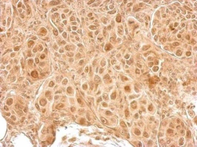 100uL Polyclonal antibody, LCMT2, host r