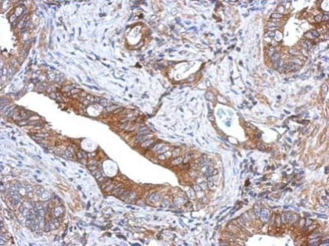 100uL Polyclonal antibody, GCNT3, host r