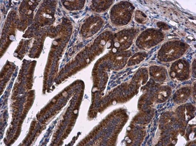 100uL Polyclonal antibody, LRRC59, host